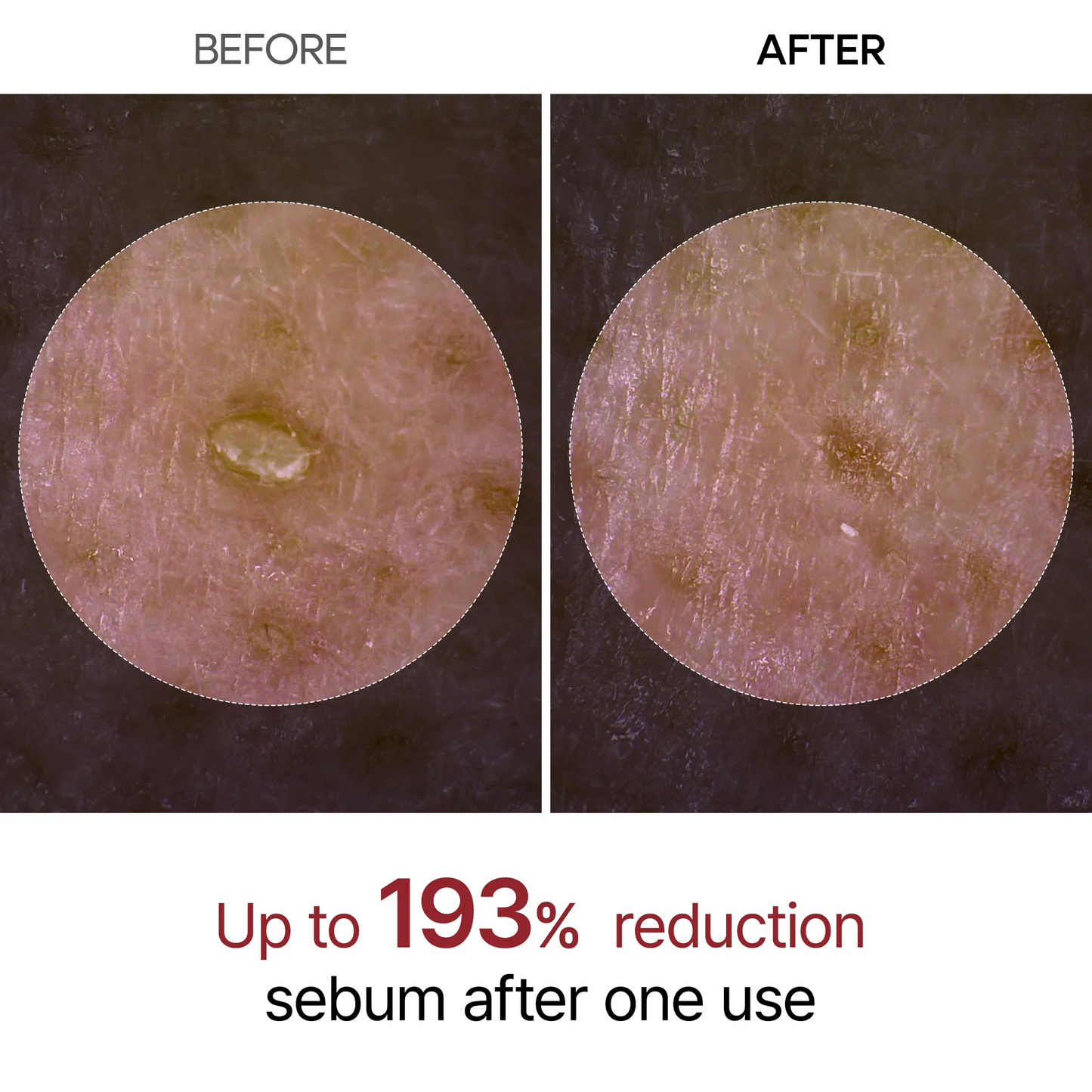 Dr. Melaxin Rice Peel Ampoule